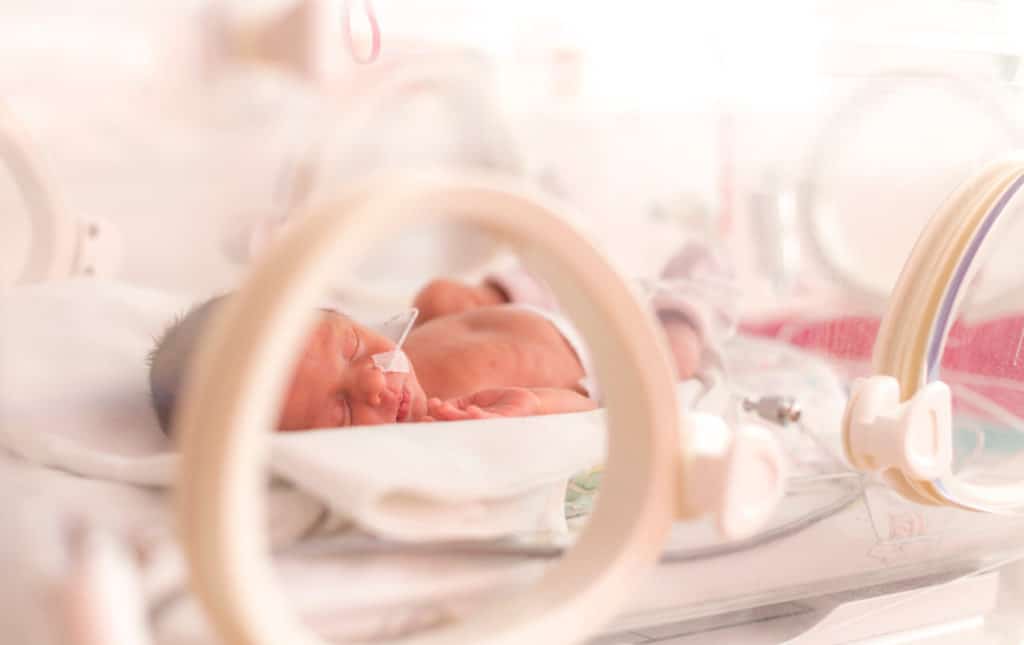premature newborn baby in an incubator